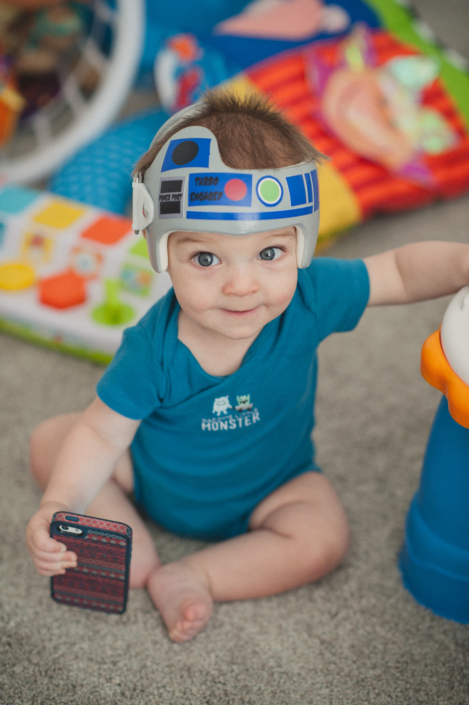 Baby with cranial helmet decorated like R2D2 from Star Wars
